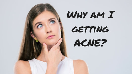 Why am I getting ACNE? -5 min read-